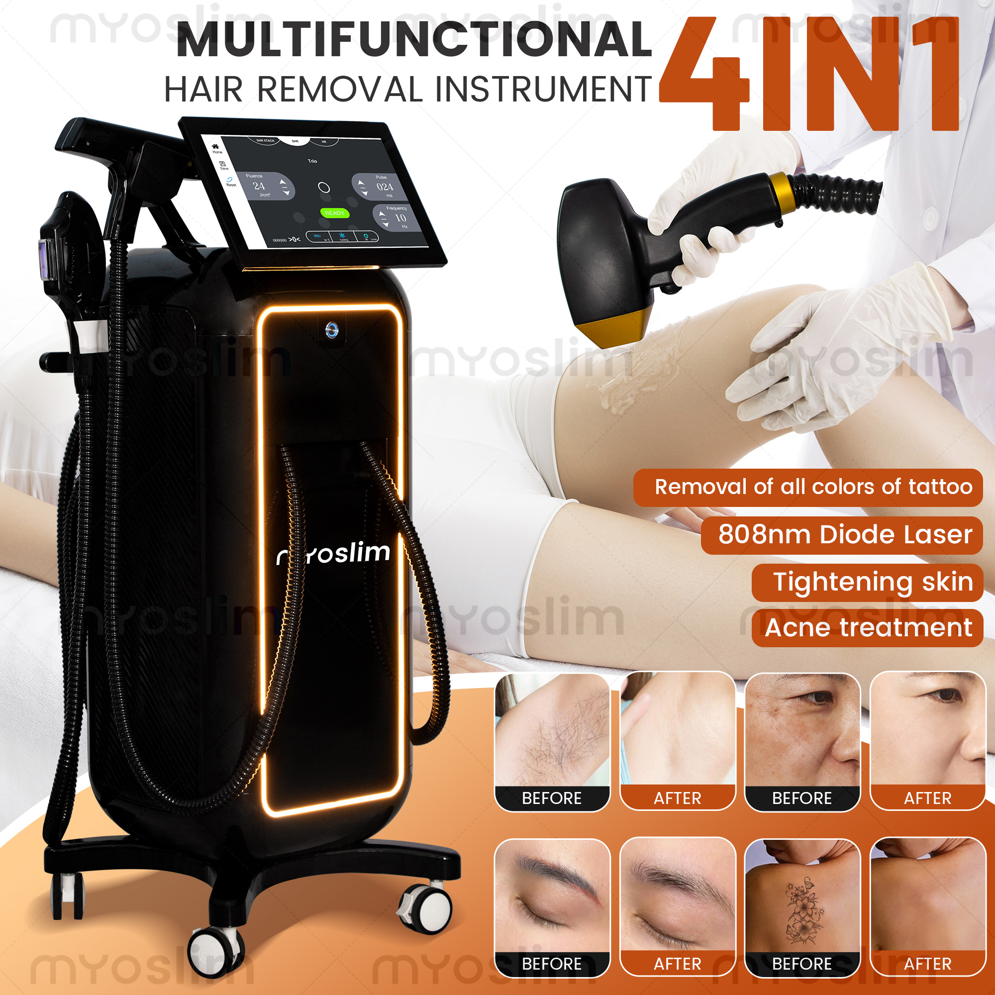 Soprano 4 in 1  Diode Hair Rem – Industrial Laser Cleaning Machine recenzja i cena
